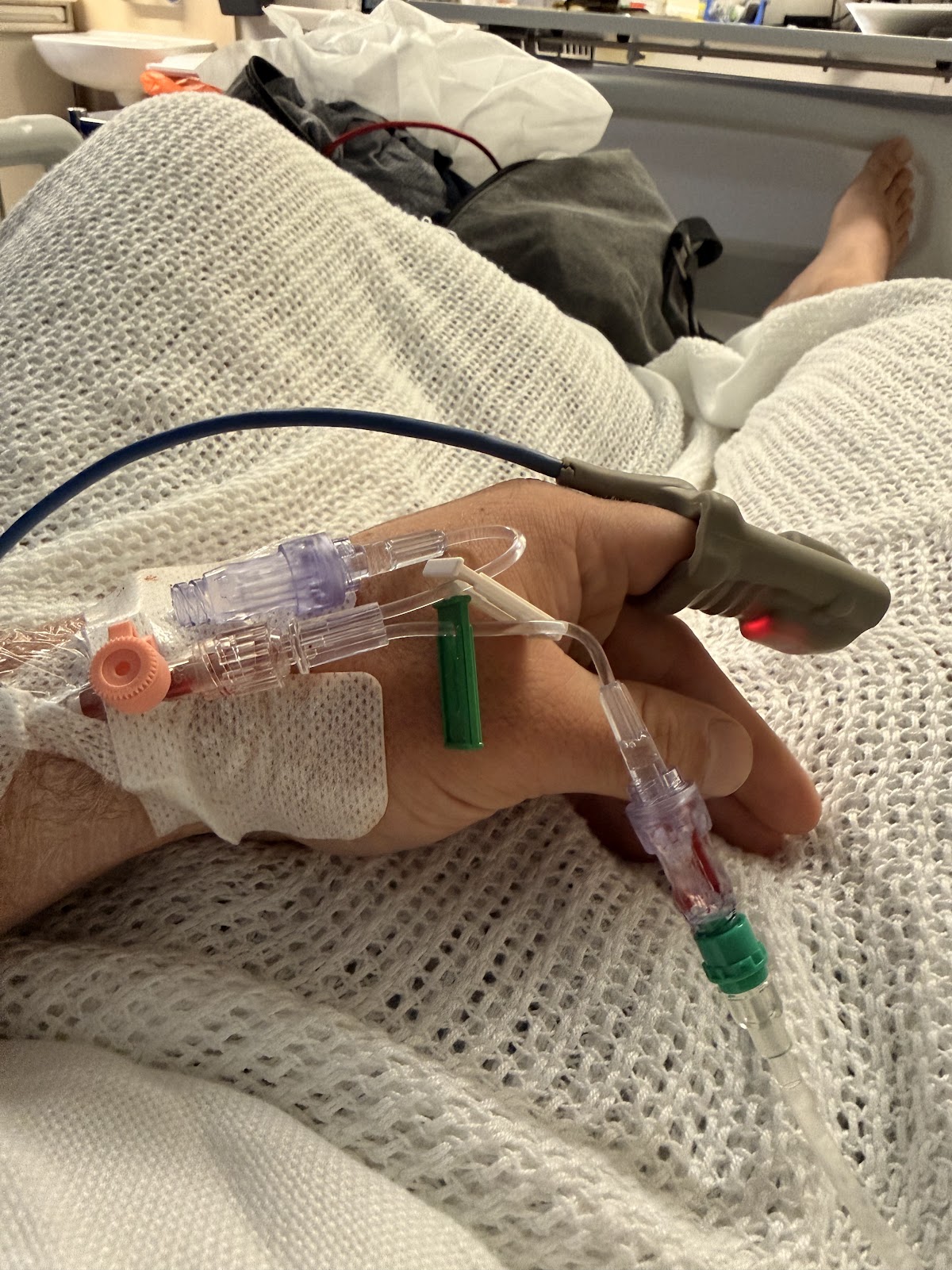 Cannulas and monitoring lines in hand during the first night in A&E