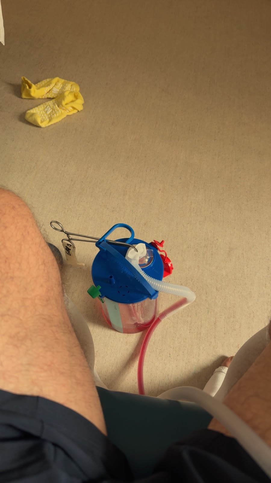Chest drain collection unit connected during the hospital admission