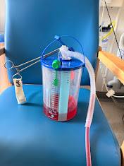 Chest drain collection bottle and tubing while the drain was clamped before removal